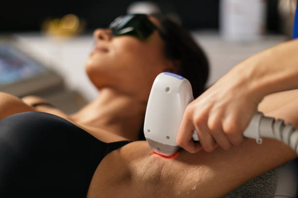 épilation laser à Villefranche