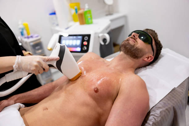 épilation laser à Villefranche